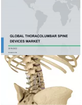 Global Thoracolumbar Spine Devices Market 2018-2022